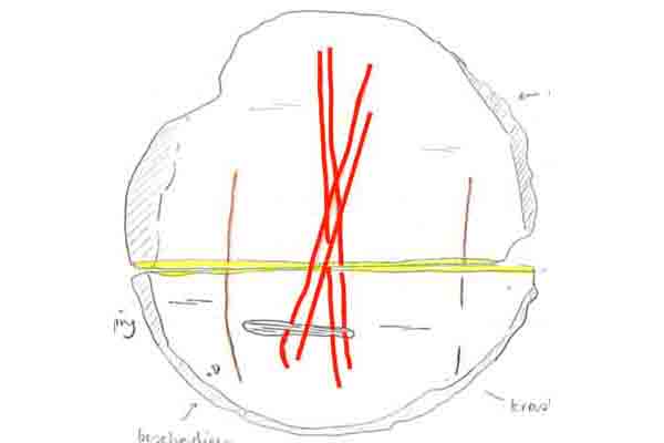 Image Alt Text